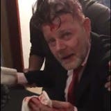 Patrick Altendorfer in einem Video gleich nach der Messerattacke. (Bild: PD)