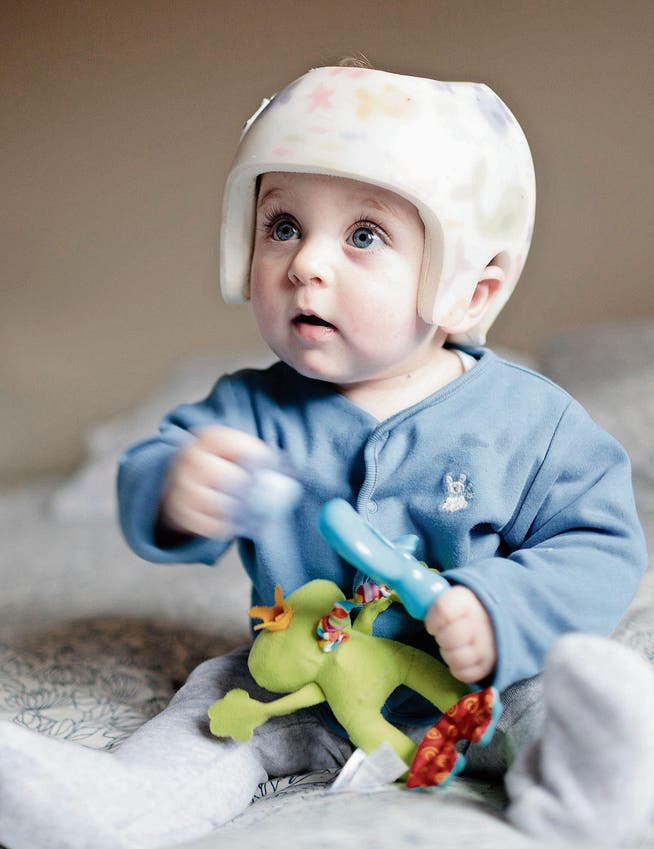 Ein Helm kann mithelfen, Kopfdeformitäten beim Kleinkind auszugleichen. (Bild: Getty)