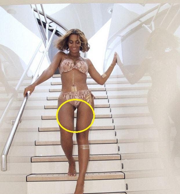 Dass Beyoncé in Sachen Oberschenkel immer wieder schummelt, zeigt auch dieses Foto. Nichts bemerkt? Auch nicht die schiefe Treppenstufe zwischen ihren Beinen? (Bild: tumblr)