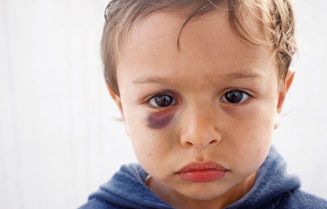 Schläge verursachen mehr als ein blaues Auge; Kinder leiden auch psychisch darunter. Das Bewusstsein dafür ist in der Schweiz zu wenig verbreitet. (Bild: Getty)