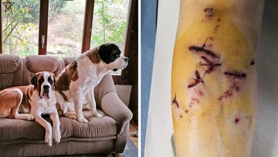 Die beiden Bernhardiner sind mittlerweile beschlagnahmt worden. Eins der Tiere hatte in Gaissau eine Frau ins Bein gebissen und verletzt. (Bilder: pd)
