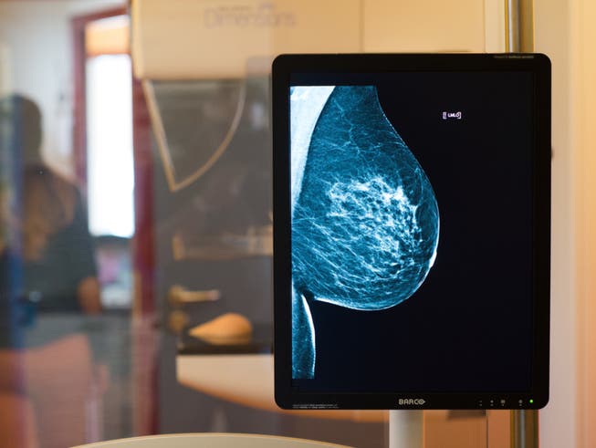 Sensible Daten aus Mammographie-Screenings oder anderen medizinischen Untersuchungen sind auf ungeschützten Servern gelandet und damit frei zugänglich. (Bild: Keystone/DPA zb/KLAUS-DIETMAR GABBERT)