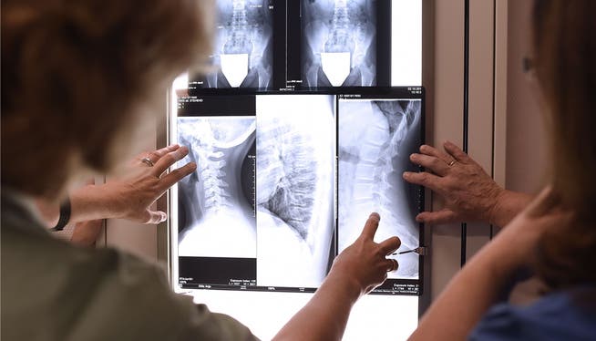 Das Kantonsspital Baselland macht abtrünnigen Patienten das Leben schwer: In etlichen Fällen mussten diese etwa Röntgenbilder selber einfordern (Symbolbild).