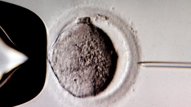 Das Volk muss entscheiden, ob Paare bei einer künstlichen Befruchtung Embryonen untersuchen lassen dürfen.