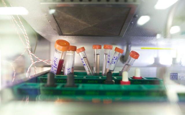 Bereits eine unterschiedliche Lagerung der Blutproben im Kühlschrank kann einen Test verfälschen. Foto: HO