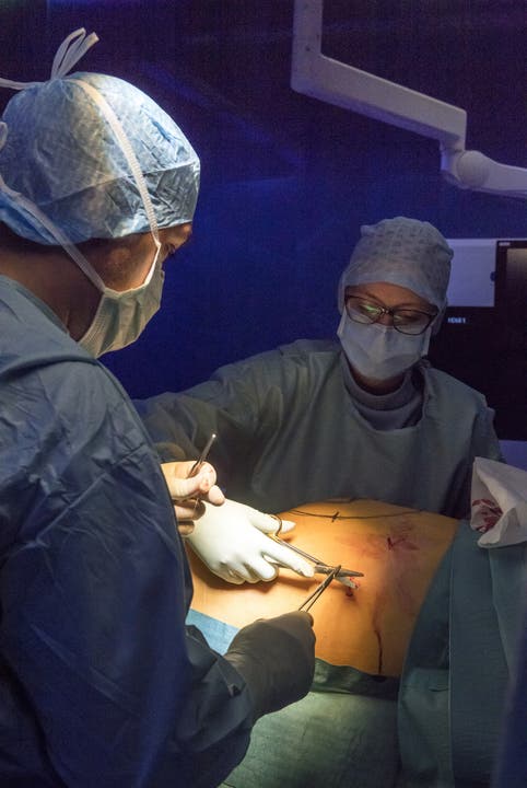 Die az durfte den Ärzten vom Kantonsspital Baden bei einer Operation zweier Brüche in der Bauchdecke über die Schultern sehen.