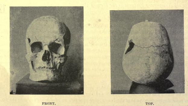 Dieser Schädel gehörte womöglich dem für seine Zeit riesigen Pharao Sa-Nakht, der vor 4700 Jahren gelebt hat.