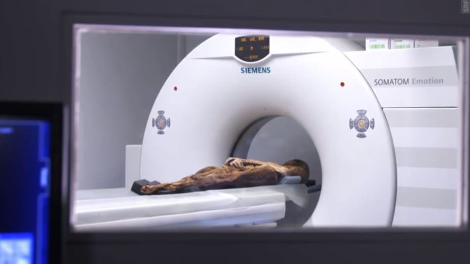 Tomografie der berühmtesten Mumie der Schweiz.