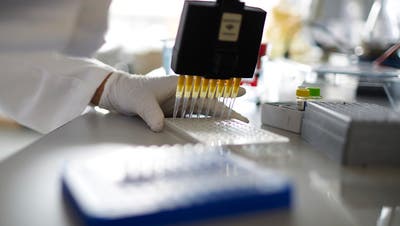 Zürcher Wissenschaftler stoss auf vielversprechender Spur für HIV-Impfstoff