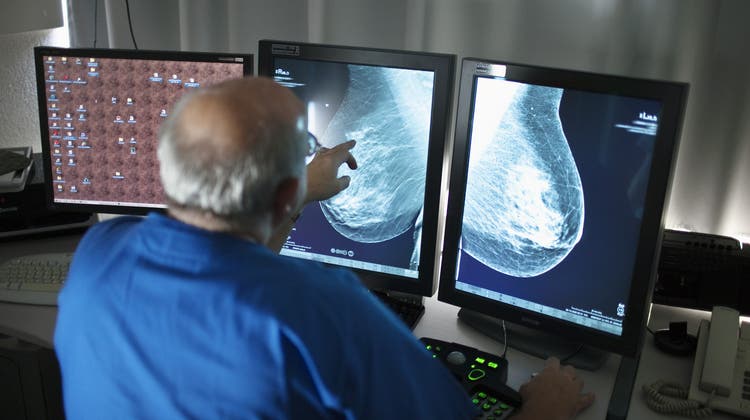 Solothurn setzt auf Brustkrebs-Früherkennung – jetzt liegt es am Kantonsrat