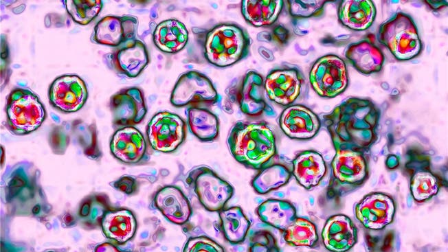 Fast ein bisschen wie Kunst: So sieht das Masern-Virus unter dem Mikroskop aus.