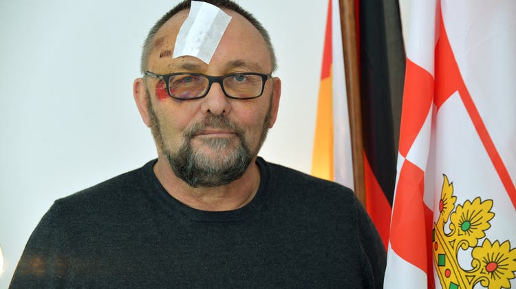 Attacke auf AfD-Magnitz: Jetzt ist klar, woher die Verletzungen stammen
