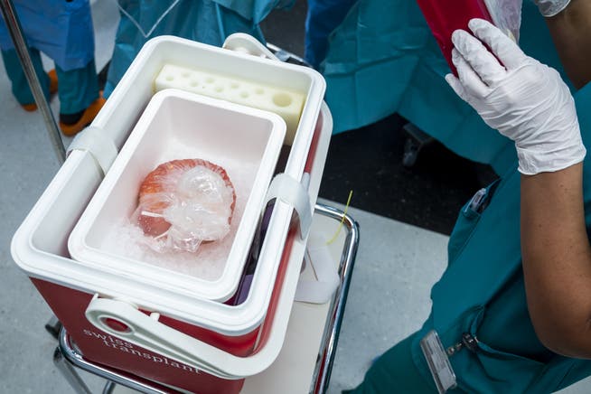 Eine Niere vor der Transplantation. Die Warteliste für lebensrettende Organe ist hierzulande lang. Das soll sich nun ändern.