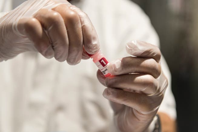 Wichtige Tests: Je weniger Vorurteile gegenüber HIV-Positiven es gibt, desto eher lassen sich Risikopersonen testen. (Symbolbild)