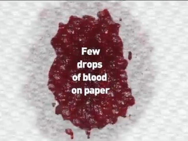 Screenshot aus dem Twitter-Werbefilm der Welt-Anti-Doping-Agentur (Wada) über ihr erleichtertes Blutanalyseverfahren DBS (Wada)