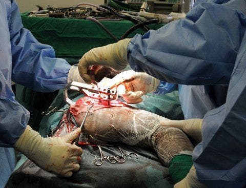 Tigerin Girl wird das Implantat mit dem Hüftknochen verschraubt