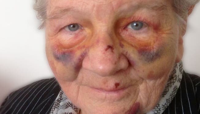 Die Rentnerin stürzte und schlug mit dem Gesicht auf. TeleM1