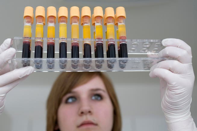 Aus regulären Blutabnahmen werden für das Forschungsprojekt Proben abgezweigt.