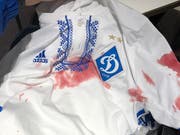 Auch das Dress des Dynamo-Kiew-Fans ist blutbefleckt. (Bild: Leserbild)