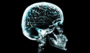 Kampfzone Gehirn. Die Forschung war bis jetzt gegen die Alzheimer-Krankheit nicht sehr erfolgreich. (Bild: Getty Images)