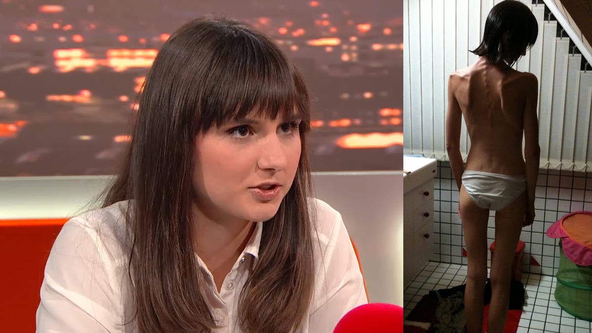 Magersucht Sie Hungerte Sich Fast Zu Tode Mein Herz Begann Sich Abzubauen