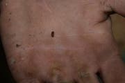 Der Borkenkäfer ist mit seinen fünf Millimetern Länge kaum zu sehen. (Bild: Beat Lanzendorfer)