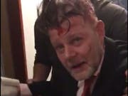 Patrick Altendorfer in einem Video gleich nach der Messerattacke. (Bild: PD)