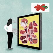 Auf Online-Plattformen erfahren Patienten, mit welchen Eingriffen Spitäler am meisten Erfahrung haben. (Bild: Illustration: Patric Sandri)