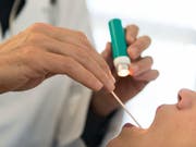 Wer zum Arzt geht, soll künftig einen grösseren Teil der Kosten selber tragen. (Bild: KEYSTONE/CHRISTIAN BEUTLER)