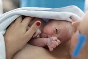 Das Geburtshaus St.Gallen soll in der Nähe des Kantonsspitals im Osten der Stadt entstehen. Bei Komplikationen würden Schwangere ins Spital verlegt werden. (Bild: KEYSTONE/Gaetan Bally)