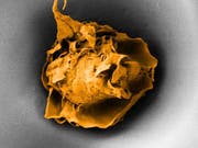 Eingezwängt in eine Pore mit nur 20 Mikrometern Durchmesser verhält sich die Fresszelle ruhig. (Elektronenmikroskopische Aufnahme) (Bild: ETH Zürich / Nikhil Jain und Isabel Gerber)