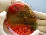Immer mehr Bakterien lassen sich nicht mehr mit Antibiotika bekämpfen. Tausende Menschen sterben jedes Jahr an den Infektionen. (Bild: KEYSTONE/AP/MARTIN ANGELSTEIN)