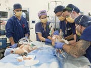 An der Operation waren über 20 Ärzte, Krankenschwestern und Pfleger beteiligt. (Bild: Keystone/AP)