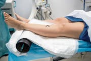 Eine Metallplatte wird aus dem Sprunggelenk einer Patientin entfernt: Im neuen Ambulatorium der Hirslanden Klinik St. Anna im Luzerner Bahnhof dauert der Eingriff inklusive Ruhezeit nur knapp vier Stunden. (Bild: Philipp Schmidli (Luzern, 18. Dezember 2018))