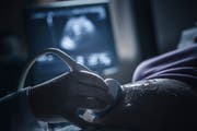 Kritiker monieren, dass Frauen mit einer frühen Fehlgeburt benachteiligt werden. (Bild: John Fedele/Getty)