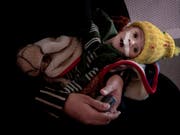 132 Millionen Menschen werden 2019 von internationaler Hilfe abhängig sein: Das verhungernde viermonatige Baby Gawad Awad in Aden, Jemen. (Bild: KEYSTONE/AP/NARIMAN EL-MOFTY)