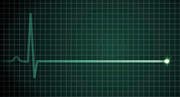 Der Ausschlag bei einem Elektrokardiogramm (EKG) zeigt die Frequenz unseres Herzschlags - die gerade Linie den Herzstillstand. (Bild: Getty)