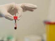 Blutprobe eines Patienten. Cholesterinsenker (Statine), haben wahrscheinlich einen positiven Effekt auf die Krebssterblichkeit. (Symbolbild) (Bild: Keystone/CHRISTIAN BEUTLER)