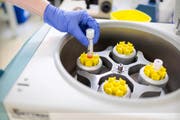 Am 5. Juni stimmt das Volk über das Fortpflanzungsgesetz ab. Im Bild: Samenflüssigkeit wird in einer Zentrifuge für eine künstliche Befruchtung aufbereitet. (Bild: Keystone/Gaetan Bally)