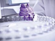 Scientist using equipment in lab --- Image by © Monty Rakusen/cultura/Corbis (Bild: Monty Rakusen)