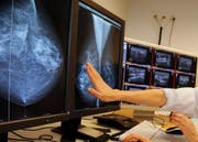 Susanne Bucher, Leiterin Brustzentrum Kantonspital und Frouwke Kremer (blode Haare) betrachten Mommagrafien am Computer und Rontgenbilder in der Frauenklinik Luzern, am 8. April 2008. (Bild: Boris Bürgisser (Neue LZ) (Neue Luzerner Zeitung))