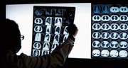 Lebensgefährlich oder harmlos? Bilder aus dem Computertomografen zeigen Veränderungen an. (Bild:Andy Wong/AP)