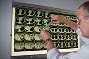 Todesfälle, die auf Krebs zurückzuführen sind, nehmen laut Stefan Aebi, Chefarzt der medizinischen Onkologie am Luzerner Kantonsspital, ab. (Symbolbild) (Bild: Roger Grütter / Neue LZ)