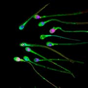 Sperma-Allergie ist eine sehr seltene Reaktion des Immunsystems. (Bild: Keystone)