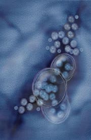 So sieht das gefährliche und ansteckende Norovirus unter dem Mikroskop aus. (Bild: Fotolia)