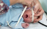 Im vergangenen Jahr kamen in Herisau 784 und in Heiden 314 Babys auf die Welt. (Bild: Keystone/ Gaetan Bally)