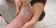 Füsse brauchen regelmässige Pflege. (Bild: pd)