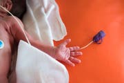 OaS Reportage aus der Neonatologie des Kinderspital St. Gallen @ Urs Bucher/Tagblatt (Bild: Urs Bucher)