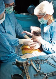 Beim Kaiserschnitt holen die Ärzte das Baby hinter dem grünen Tuch aus dem Bauch heraus. Bei der Kaisergeburt hingegen kann die Mutter in der Endphase zusehen. (Bild: Canopy/Getty)