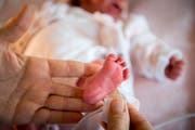 OaS Reportage aus der Neonatologie des Kinderspital St. Gallen @ Urs Bucher/Tagblatt (Bild: Urs Bucher (Urs Bucher))